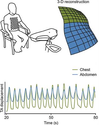 Measuring Ventilatory Activity with Structured Light Plethysmography (SLP) Reduces Instrumental Observer Effect and Preserves Tidal Breathing Variability in Healthy and COPD